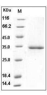 Human Ficolin-1 / Ficolin-A / FCN1 Protein (His Tag) SDS-PAGE