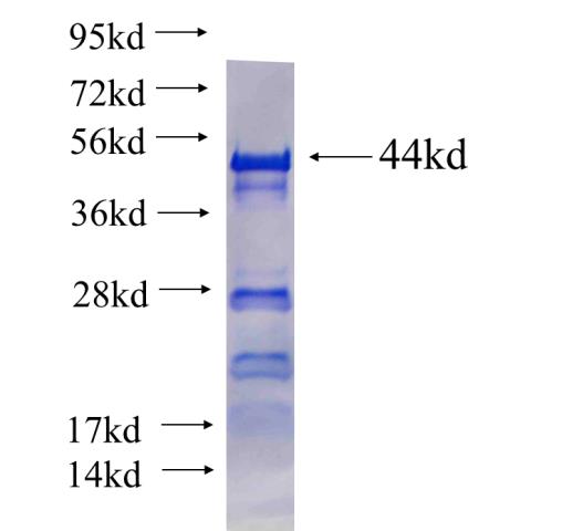 Recombinant human CWC22 SDS-PAGE