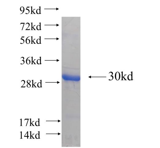 Recombinant human MRPS15(Full length) SDS-PAGE