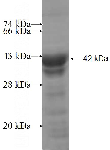 Recombinant Human PKN1 SDS-PAGE