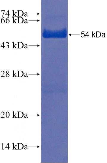 Recombinant Human THEM5 SDS-PAGE