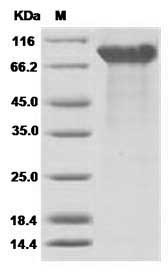 Ebola virus EBOV (subtype Zaire, strain H.sapiens-wt/GIN/2014/Kissidougou-C15) Glycoprotein / GP1 Protein (His Tag)