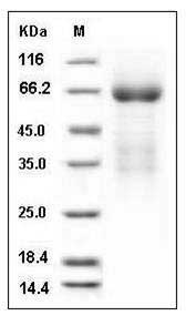 Mouse LY9 / CD229 / SLAMF3 Protein (His Tag) SDS-PAGE