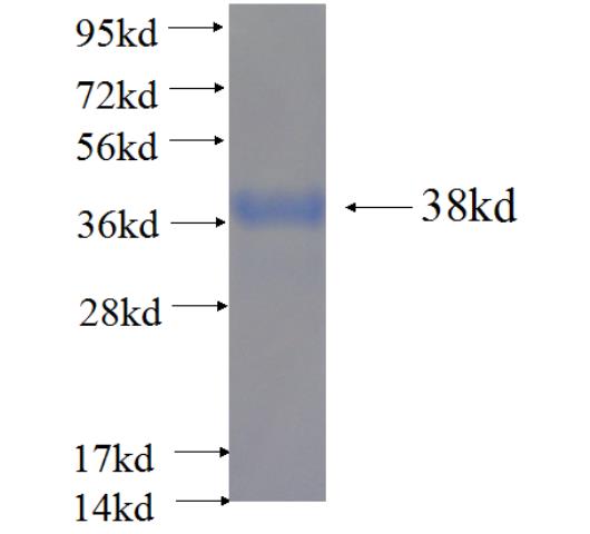 Recombinant human LRRFIP1 SDS-PAGE