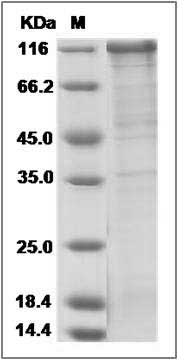 Human FSTL5 Protein (Fc Tag) SDS-PAGE