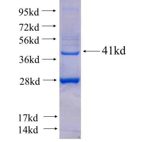 Recombinant human PFN1(Full length) SDS-PAGE