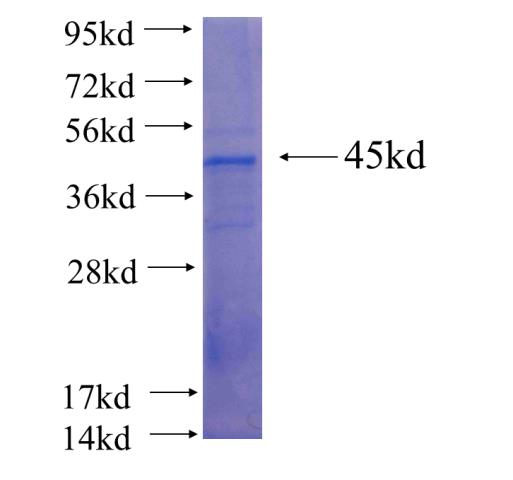 Recombinant human RB1 SDS-PAGE