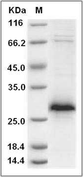 Rat XEDAR / EDA2R Protein (His Tag) SDS-PAGE