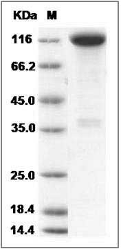 Mouse TrkA / NTRK1 Protein (Fc Tag) SDS-PAGE