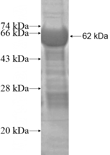 Recombinant Human CPPED1 SDS-PAGE