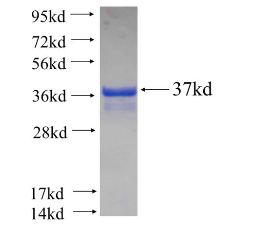 Recombinant Arabidopsis thaliana ACD2 SDS-PAGE