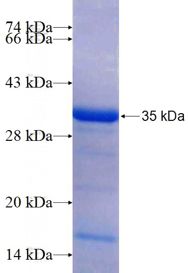 Recombinant Human ECHDC3 SDS-PAGE