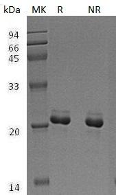 Human MAX/BHLHD4 (His tag) recombinant protein