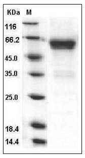 Mouse CD27 / TNFRSF7 Protein (His & Fc Tag) SDS-PAGE