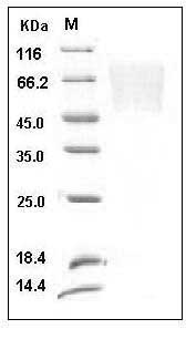 Human Fractalkine / CX3CL1 Protein (His Tag) SDS-PAGE
