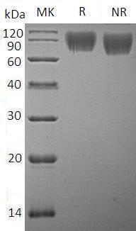 Human ICAM1 (His tag) recombinant protein