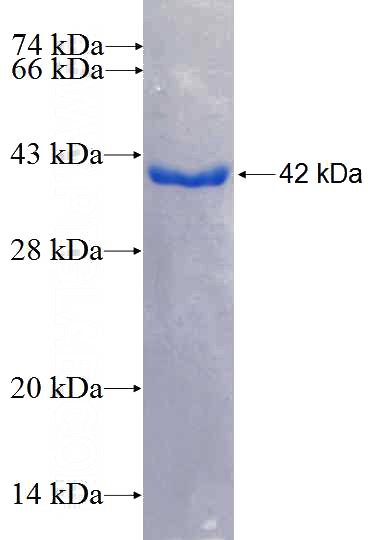 Recombinant Human BRDT SDS-PAGE