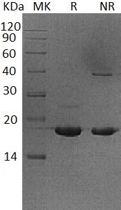Human UBE2V2/MMS2/UEV2 (His tag) recombinant protein