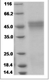 Human OGN/osteoglycin Protein 15324