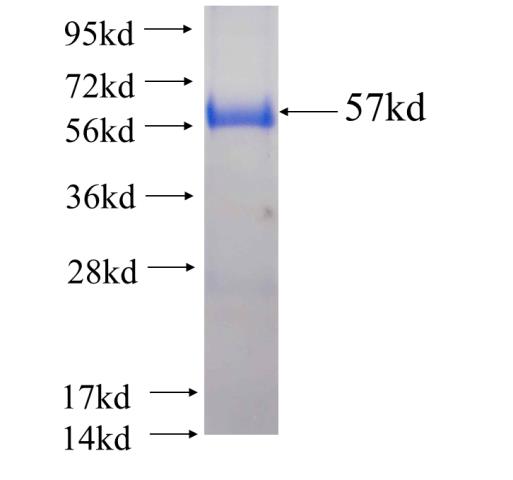 Recombinant human FHL3 SDS-PAGE