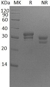 Human VSIG2/CTH/CTXL/UNQ2770/PRO7154 (His tag) recombinant protein