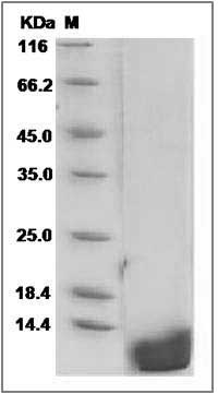 Rat EGF / Epidermal Growth Factor Protein SDS-PAGE