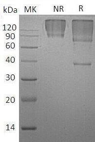 Human GPC3/OCI5 (His tag) recombinant protein