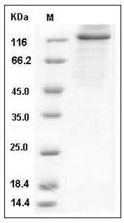 Human PRKD2 / PKD2 Protein (His & GST Tag) SDS-PAGE