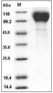 Human Immunodeficiency Virus type 1 (HIV-1) gp120 / SU Protein (His Tag) SDS-PAGE