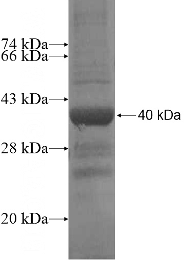Recombinant Human OVCA1 SDS-PAGE