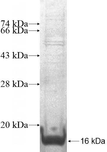 Recombinant Human GLB1L3 SDS-PAGE