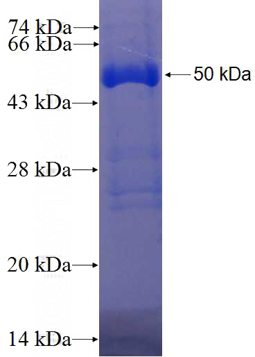 Recombinant Human EIF3D SDS-PAGE