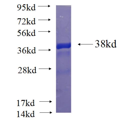 Recombinant human PAGE2 SDS-PAGE