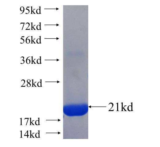 Recombinant human C10orf97 SDS-PAGE