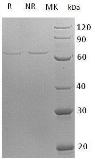 Human AIFM1/AIF/PDCD8 (His tag) recombinant protein
