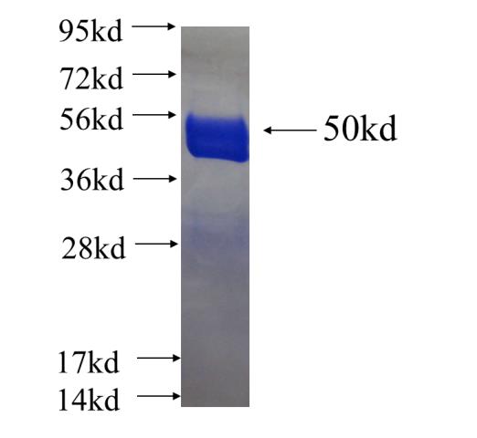 Recombinant human RAB11A SDS-PAGE