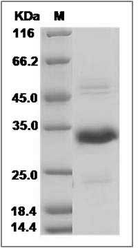 Mouse CRISP-1 / CRISP1 Protein (His Tag) SDS-PAGE