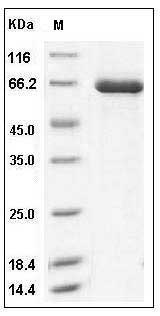 Human TLK2 / PKU-ALPHA Protein (aa 397-772, His & GST Tag) SDS-PAGE