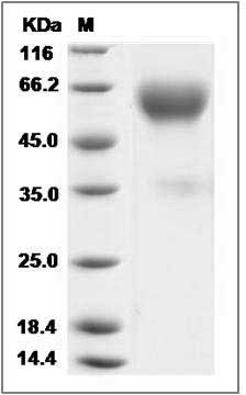 Canine TrkA / NTRK1 Protein (Fc Tag) SDS-PAGE