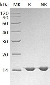 Human FIS1/TTC11/CGI-135 (His tag) recombinant protein