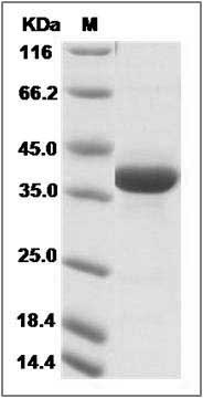 Human CART / CARTPT Protein (Fc Tag) SDS-PAGE