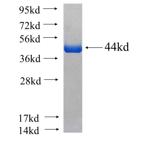 Recombinant human INTS10 SDS-PAGE