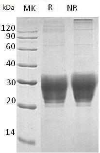 Human NPDC1 (His tag) recombinant protein