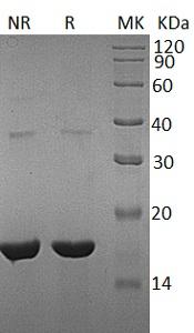 Human REG3G/PAP1B/UNQ429/PRO162 (His tag) recombinant protein