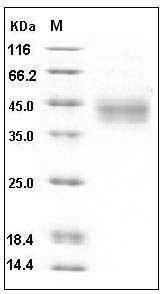 Human IL20RA Protein (His Tag) SDS-PAGE
