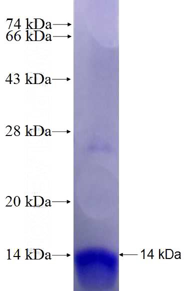 Recombinant Human GCGR SDS-PAGE