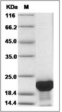 Human TPPP3 Protein (His Tag) SDS-PAGE