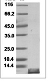 Mouse CCL20/MIP-3 alpha/MIP3A Protein 15091