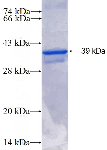 Recombinant Human PRDM5 SDS-PAGE