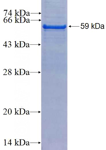 Recombinant Human CHMP2A SDS-PAGE